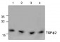 TGF-beta2 Antibody